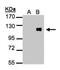Zinc Finger Protein 281 antibody, NBP2-20984, Novus Biologicals, Western Blot image 