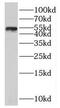 Solute Carrier Family 30 Member 6 antibody, FNab07950, FineTest, Western Blot image 