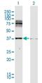 Short transient receptor potential channel 2 antibody, H00001638-D01P, Novus Biologicals, Western Blot image 