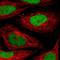 SET Nuclear Proto-Oncogene antibody, HPA063683, Atlas Antibodies, Immunocytochemistry image 