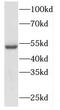 Dihydrolipoamide Branched Chain Transacylase E2 antibody, FNab02260, FineTest, Western Blot image 