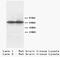 Tyrosine Hydroxylase antibody, orb18276, Biorbyt, Western Blot image 