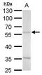 Antizyme inhibitor 2 antibody, PA5-31751, Invitrogen Antibodies, Western Blot image 