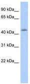 Homeobox protein OTX1 antibody, TA343739, Origene, Western Blot image 