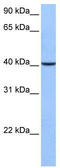 Cytosolic carboxypeptidase-like protein 5 antibody, TA336018, Origene, Western Blot image 