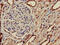 Phosphoribosyl Pyrophosphate Synthetase 2 antibody, CSB-PA018779LA01HU, Cusabio, Immunohistochemistry paraffin image 