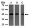 Serpin Family I Member 1 antibody, NBP1-31037, Novus Biologicals, Western Blot image 