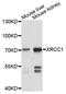 X-Ray Repair Cross Complementing 1 antibody, abx000721, Abbexa, Western Blot image 