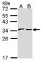 Killer Cell Lectin Like Receptor C1 antibody, LS-C185994, Lifespan Biosciences, Western Blot image 