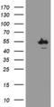 Chimerin 1 antibody, NBP2-46290, Novus Biologicals, Western Blot image 
