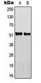 RGM domain family member B antibody, orb215604, Biorbyt, Western Blot image 