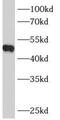 Beta-1,4-Galactosyltransferase 4 antibody, FNab00775, FineTest, Western Blot image 