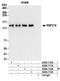 Ring Finger Protein 216 antibody, A304-110A, Bethyl Labs, Immunoprecipitation image 