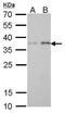 Peroxisomal Biogenesis Factor 19 antibody, MA5-17281, Invitrogen Antibodies, Western Blot image 