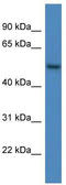Rho GTPase-activating protein 19 antibody, TA343036, Origene, Western Blot image 
