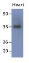 Sarcoglycan Delta antibody, AM50079PU-S, Origene, Western Blot image 