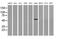 Coronin 1A antibody, MA5-25176, Invitrogen Antibodies, Western Blot image 