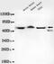 Transducin Beta Like 1 X-Linked Receptor 1 antibody, LS-C178304, Lifespan Biosciences, Western Blot image 