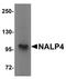 NLR Family Pyrin Domain Containing 4 antibody, LS-C115896, Lifespan Biosciences, Western Blot image 