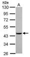 Group XV phospholipase A2 antibody, GTX120469, GeneTex, Western Blot image 