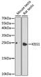 KiSS-1 Metastasis Suppressor antibody, 16-718, ProSci, Western Blot image 