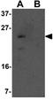 Yippee Like 1 antibody, GTX32062, GeneTex, Western Blot image 