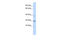 Short stature homeobox protein antibody, 25-126, ProSci, Enzyme Linked Immunosorbent Assay image 