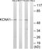 Potassium Voltage-Gated Channel Subfamily A Member 1 antibody, TA314119, Origene, Western Blot image 