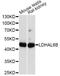 Lactate Dehydrogenase A Like 6B antibody, A14950, ABclonal Technology, Western Blot image 