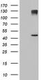 1-Acylglycerol-3-Phosphate O-Acyltransferase 5 antibody, CF504142, Origene, Western Blot image 