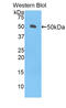 Left-Right Determination Factor 1 antibody, abx103719, Abbexa, Enzyme Linked Immunosorbent Assay image 
