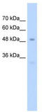 Sp7 Transcription Factor antibody, TA329359, Origene, Western Blot image 
