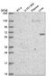 DEP Domain Containing 1B antibody, NBP2-56444, Novus Biologicals, Western Blot image 