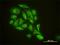 Glia Maturation Factor Beta antibody, H00002764-M01, Novus Biologicals, Immunocytochemistry image 