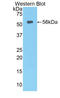 Hepatic lipase antibody, LS-C299083, Lifespan Biosciences, Western Blot image 