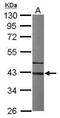 G Protein Subunit Alpha I3 antibody, GTX103676, GeneTex, Western Blot image 