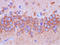 Complement Component 5a Receptor 2 antibody, AM26721PU-N, Origene, Immunohistochemistry paraffin image 