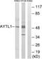 Lysophosphatidylcholine Acyltransferase 2 antibody, A07471-1, Boster Biological Technology, Western Blot image 