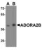 Adenosine A2b Receptor antibody, PA5-72850, Invitrogen Antibodies, Western Blot image 