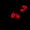 Intercellular Adhesion Molecule 1 antibody, orb382141, Biorbyt, Immunocytochemistry image 