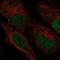 Zinc Finger Protein 594 antibody, NBP2-57914, Novus Biologicals, Immunofluorescence image 