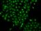 Tumor Suppressing Subtransferable Candidate 4 antibody, 204605-T02, Sino Biological, Immunohistochemistry paraffin image 