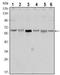 Serine/Threonine Kinase 11 antibody, AM06552SU-N, Origene, Western Blot image 