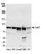 LEO1 Homolog, Paf1/RNA Polymerase II Complex Component antibody, A300-174A, Bethyl Labs, Western Blot image 