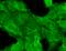 Glutamate Ionotropic Receptor NMDA Type Subunit 2B antibody, SMC-337D-PCP, StressMarq, Immunofluorescence image 