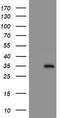 N-Ribosyldihydronicotinamide:Quinone Reductase 2 antibody, LS-C173978, Lifespan Biosciences, Western Blot image 