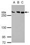 Chromodomain Helicase DNA Binding Protein 4 antibody, GTX101662, GeneTex, Western Blot image 