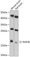 RAP2B, Member Of RAS Oncogene Family antibody, 19-266, ProSci, Western Blot image 