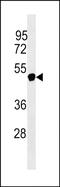 Nuclear RNA Export Factor 5 antibody, PA5-49002, Invitrogen Antibodies, Western Blot image 