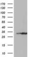 Exosome Component 7 antibody, MA5-25849, Invitrogen Antibodies, Western Blot image 